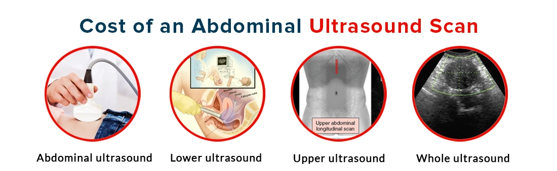 Cost of Abdominal Ultrasound Scan